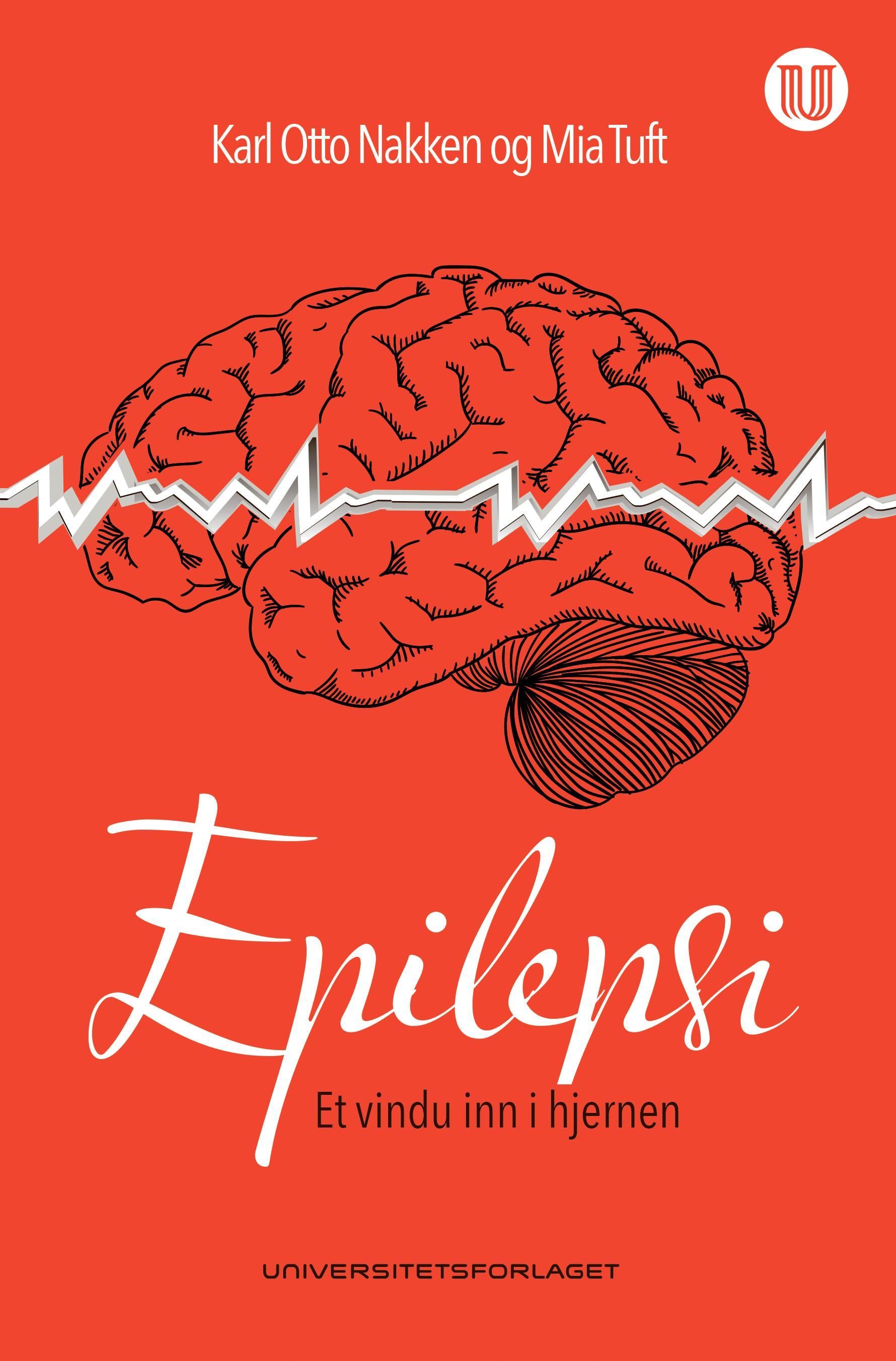 Epilepsi