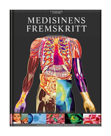 Medisinens fremskritt