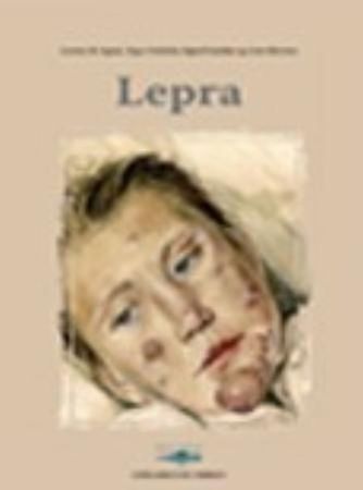 Lepra